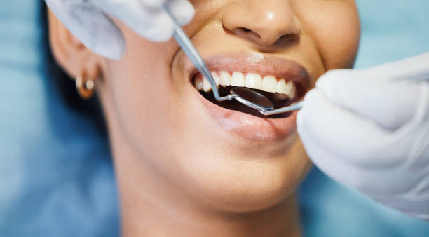 Best Emergency Root Canal Treatment in Mission, OR